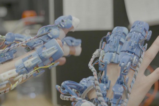 Made In Greece: Έλληνες ερευνητές αναπτύσσουν φορετό ρομποτικό σύστημα χειρουργικής